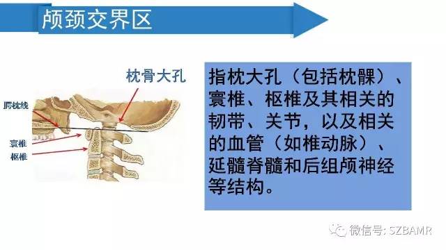 【PPT】颅底交界区畸形影像诊断