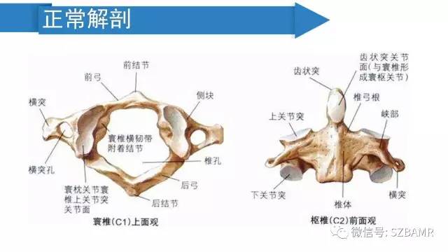 【PPT】颅底交界区畸形影像诊断