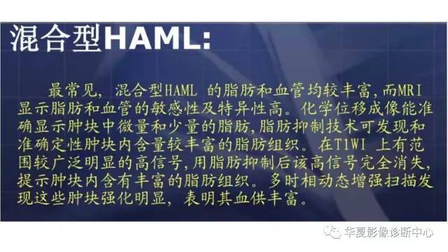 【病例】肝内多发血管平滑肌脂肪瘤1例CT及MR