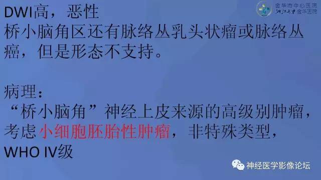 【病例】右桥小脑角区小细胞胚胎性肿瘤1例CT及MR