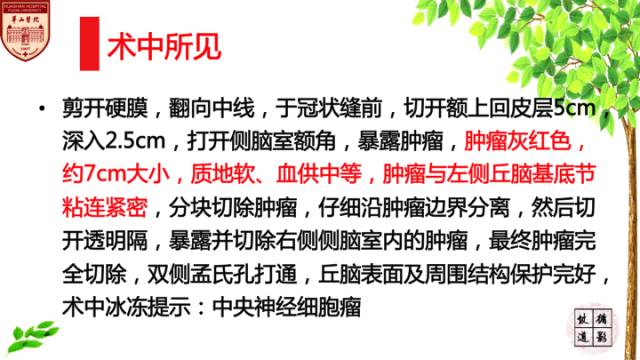 【病例】中枢神经细胞瘤1例MR影像表现 【病例】中枢神经细胞瘤1例MR影像表现