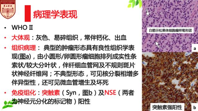 【病例】中枢神经细胞瘤1例MR影像表现 【病例】中枢神经细胞瘤1例MR影像表现