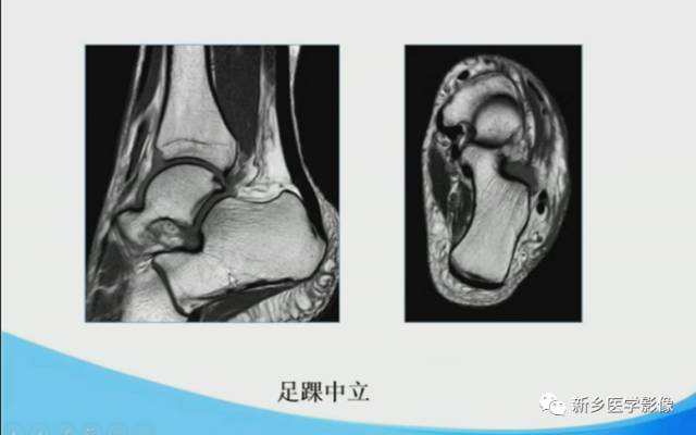 【PPT】足踝部MRI诊断