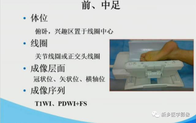 【PPT】足踝部MRI诊断