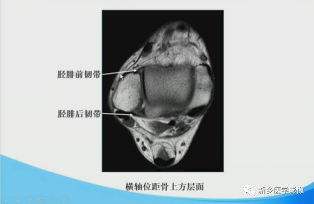【PPT】足踝部MRI诊断