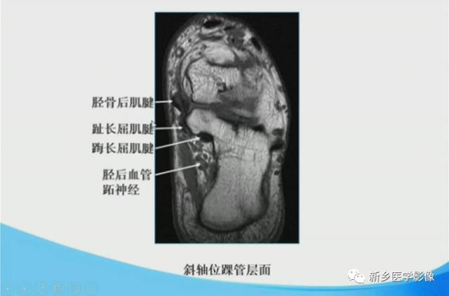 【PPT】足踝部MRI诊断