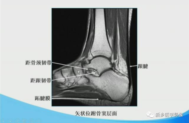 【PPT】足踝部MRI诊断