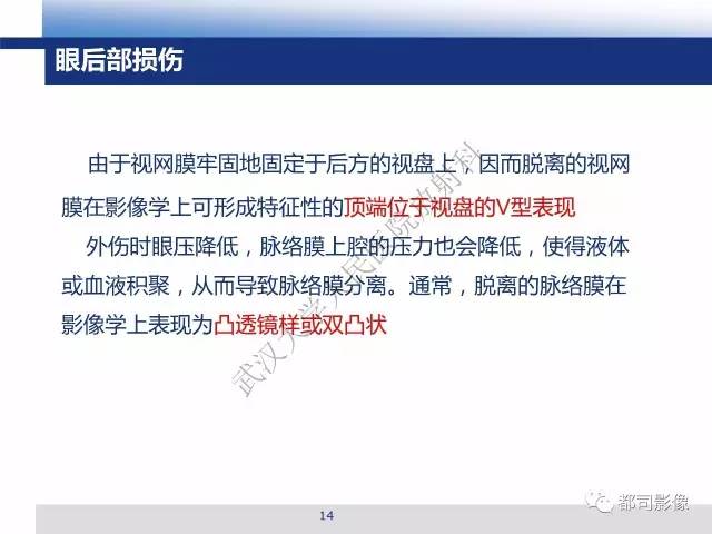 【PPT】眼球损伤影像诊断