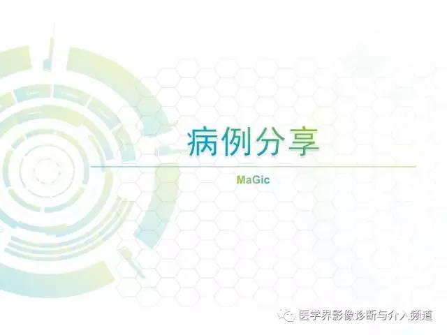 【病例】脑室内海绵状血管瘤1例