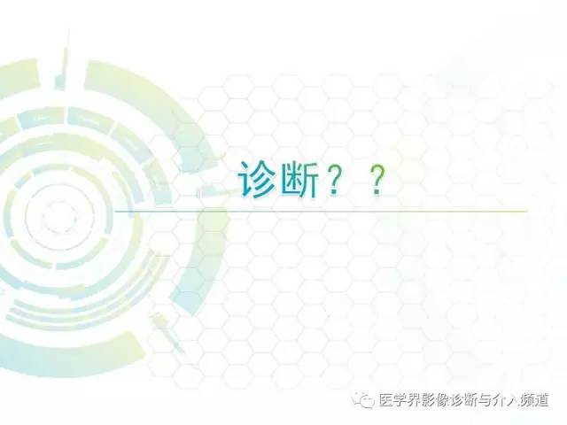 【病例】脑室内海绵状血管瘤1例