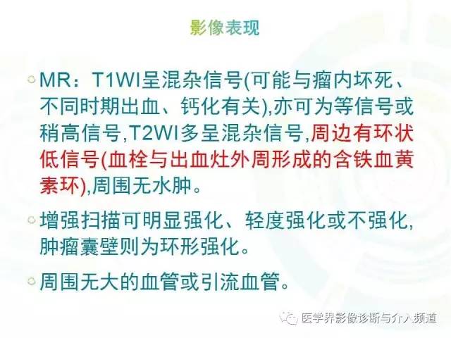 【病例】脑室内海绵状血管瘤1例