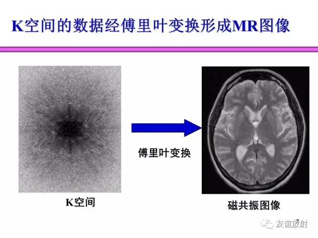 【PPT】基于K空间的MR快速成像技术