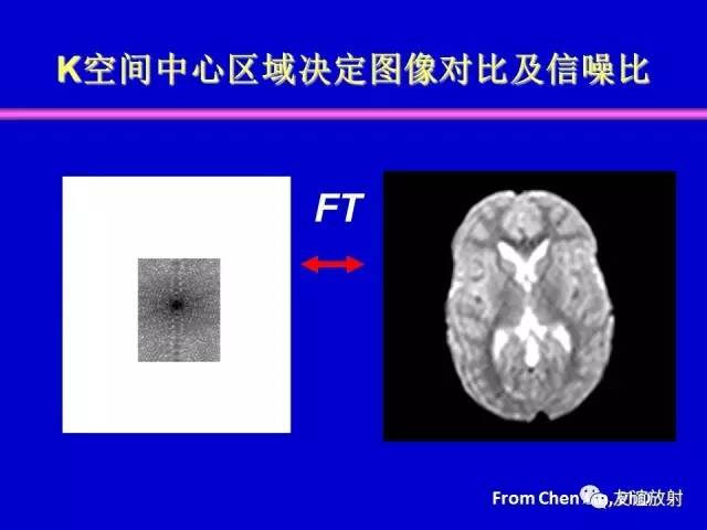 【PPT】基于K空间的MR快速成像技术