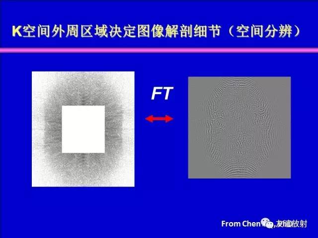 【PPT】基于K空间的MR快速成像技术