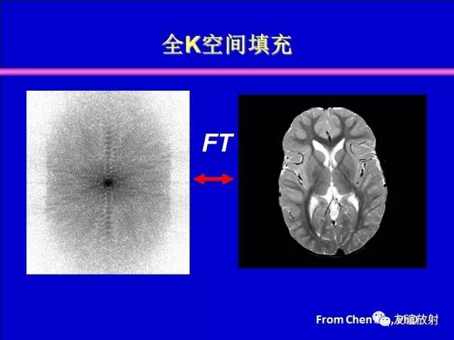 【PPT】基于K空间的MR快速成像技术