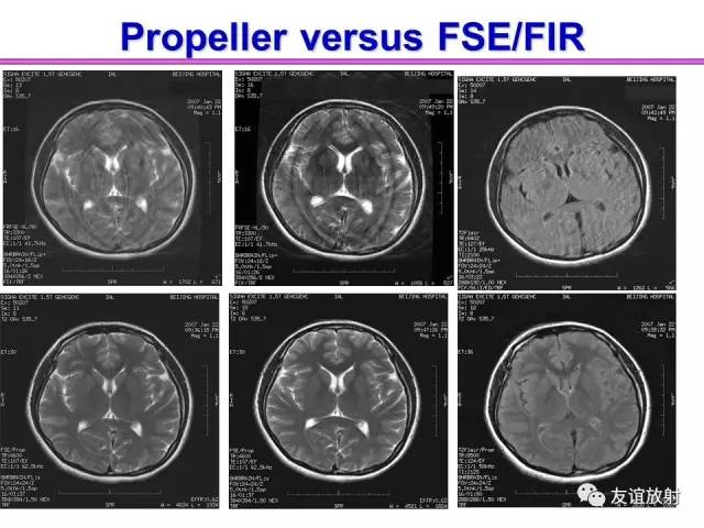 【PPT】基于K空间的MR快速成像技术