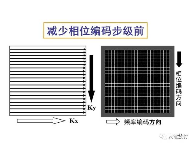 【PPT】基于K空间的MR快速成像技术