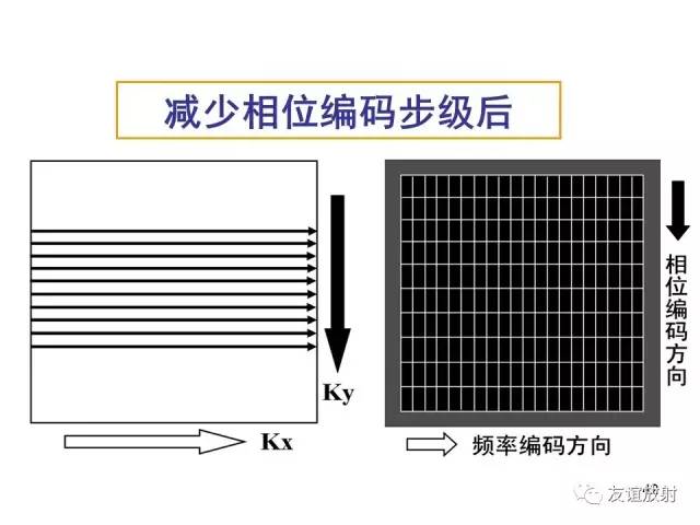 【PPT】基于K空间的MR快速成像技术