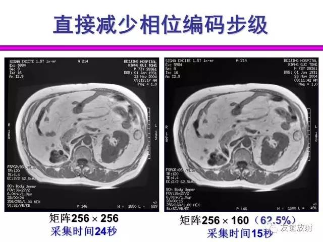 【PPT】基于K空间的MR快速成像技术