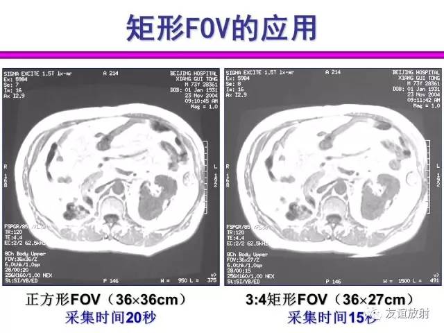 【PPT】基于K空间的MR快速成像技术
