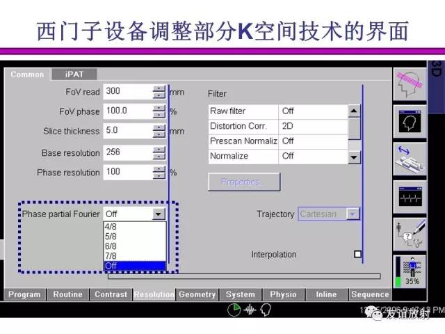 【PPT】基于K空间的MR快速成像技术