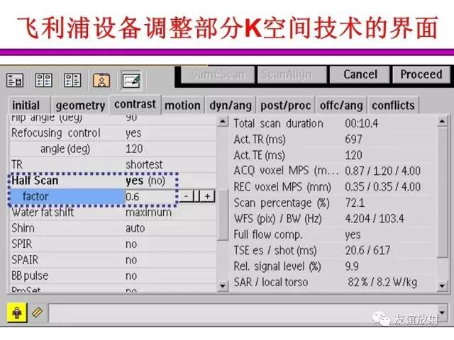 【PPT】基于K空间的MR快速成像技术