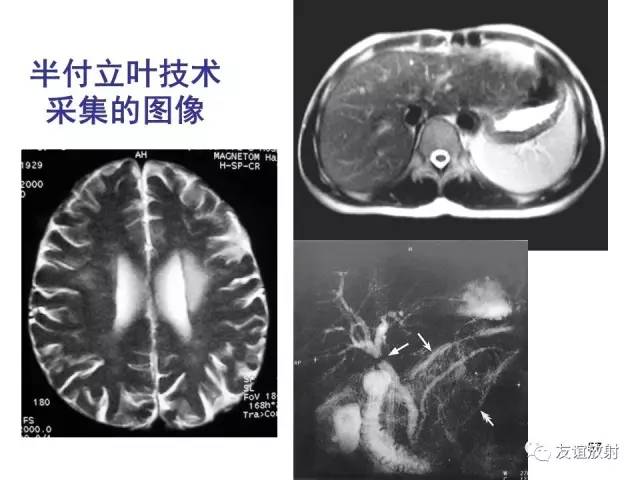 【PPT】基于K空间的MR快速成像技术