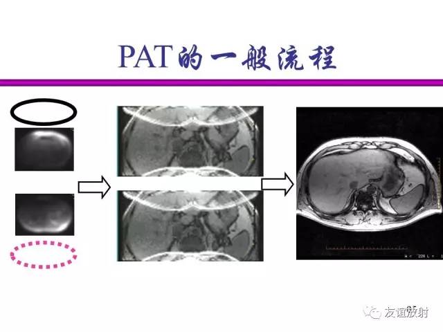 【PPT】基于K空间的MR快速成像技术