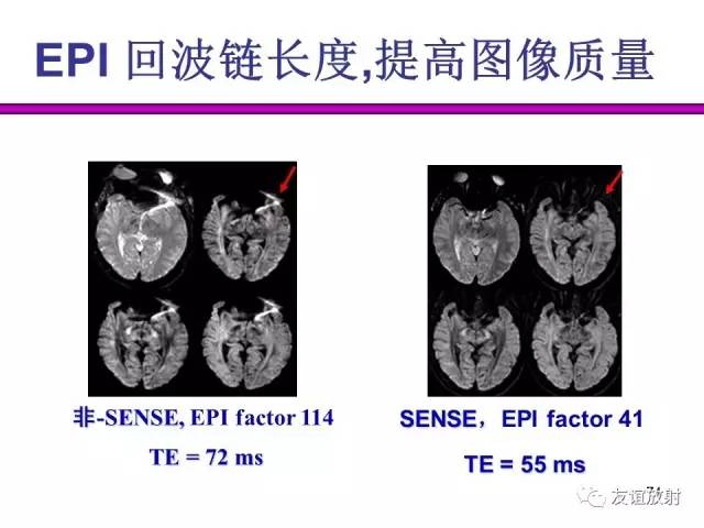 【PPT】基于K空间的MR快速成像技术