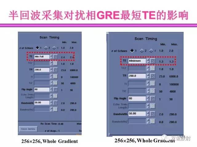 【PPT】基于K空间的MR快速成像技术