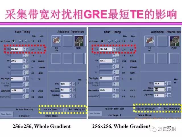 【PPT】基于K空间的MR快速成像技术