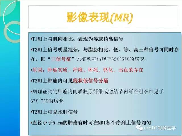 【PPT】滑膜肉瘤的影像诊断