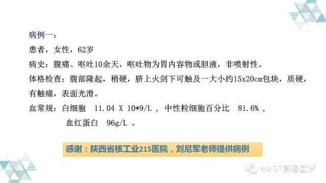 【PPT】外生型胃癌影像表现