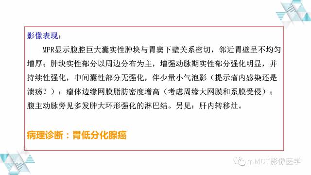 【PPT】外生型胃癌影像表现