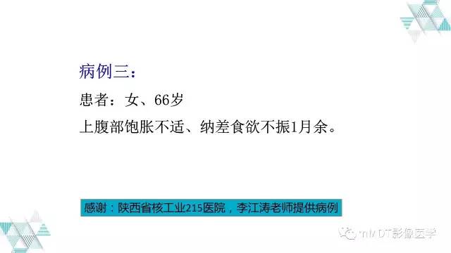 【PPT】外生型胃癌影像表现