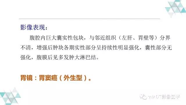 【PPT】外生型胃癌影像表现