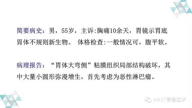 【PPT】外生型胃癌影像表现