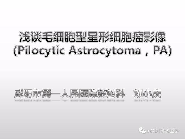 【PPT】浅谈毛细胞型星形细胞瘤影像