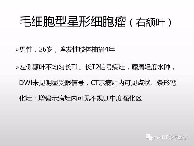 【PPT】浅谈毛细胞型星形细胞瘤影像