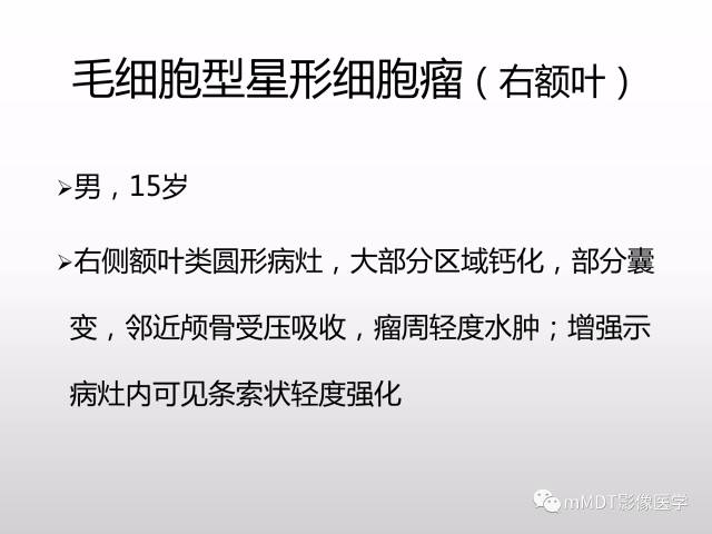 【PPT】浅谈毛细胞型星形细胞瘤影像