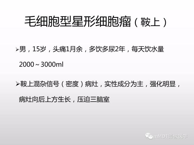 【PPT】浅谈毛细胞型星形细胞瘤影像