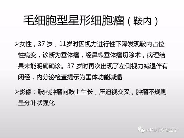 【PPT】浅谈毛细胞型星形细胞瘤影像