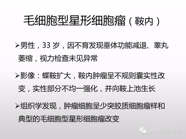 【PPT】浅谈毛细胞型星形细胞瘤影像