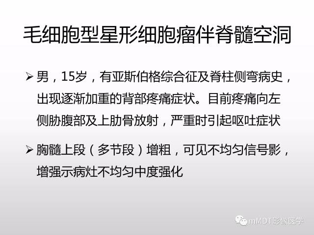 【PPT】浅谈毛细胞型星形细胞瘤影像