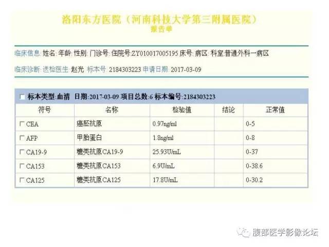 【病例】直肠乙状结肠交界处神经内分泌肿瘤1例CT