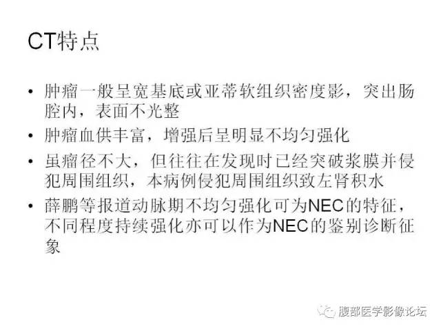 【病例】直肠乙状结肠交界处神经内分泌肿瘤1例CT