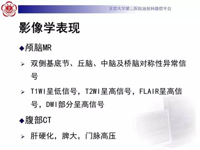 【病例】肝豆状核变性1例MR