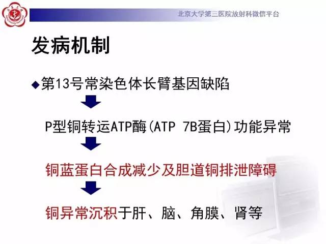 【病例】肝豆状核变性1例MR
