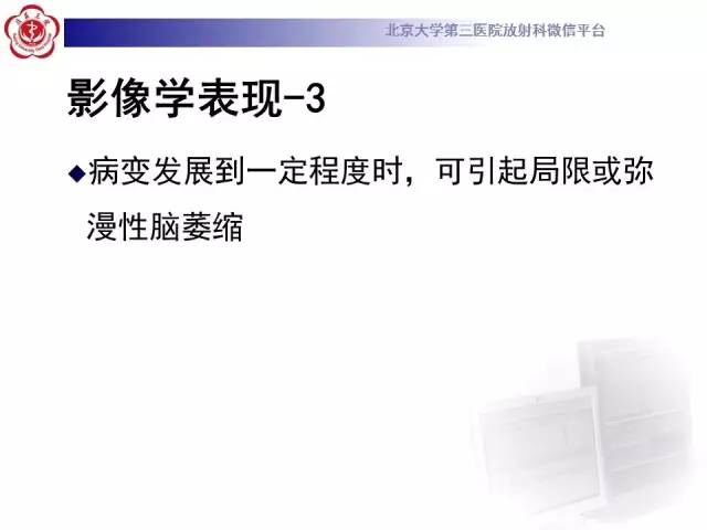 【病例】肝豆状核变性1例MR