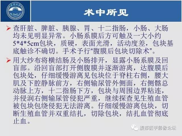 【病例】腹膜后平滑肌肉瘤1例CT影像表现 【病例】腹膜后平滑肌肉瘤1例CT影像表现